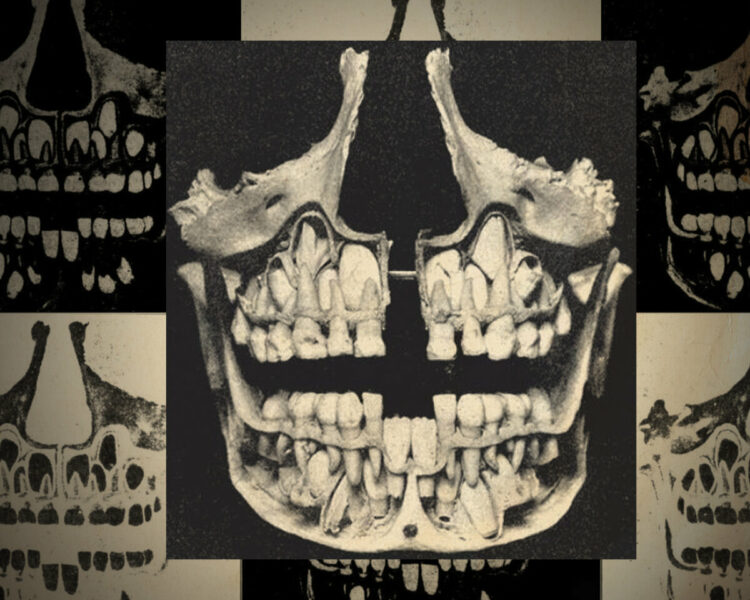 X-rays of kids’ skulls as their baby teeth get pushed out and their permanent teeth grow in