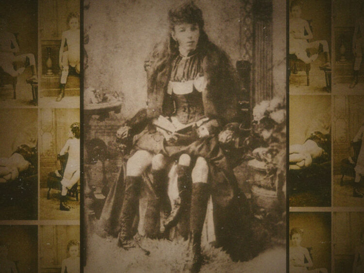 Blanche Dumas- The woman with three legs, four breasts, and two vaginas