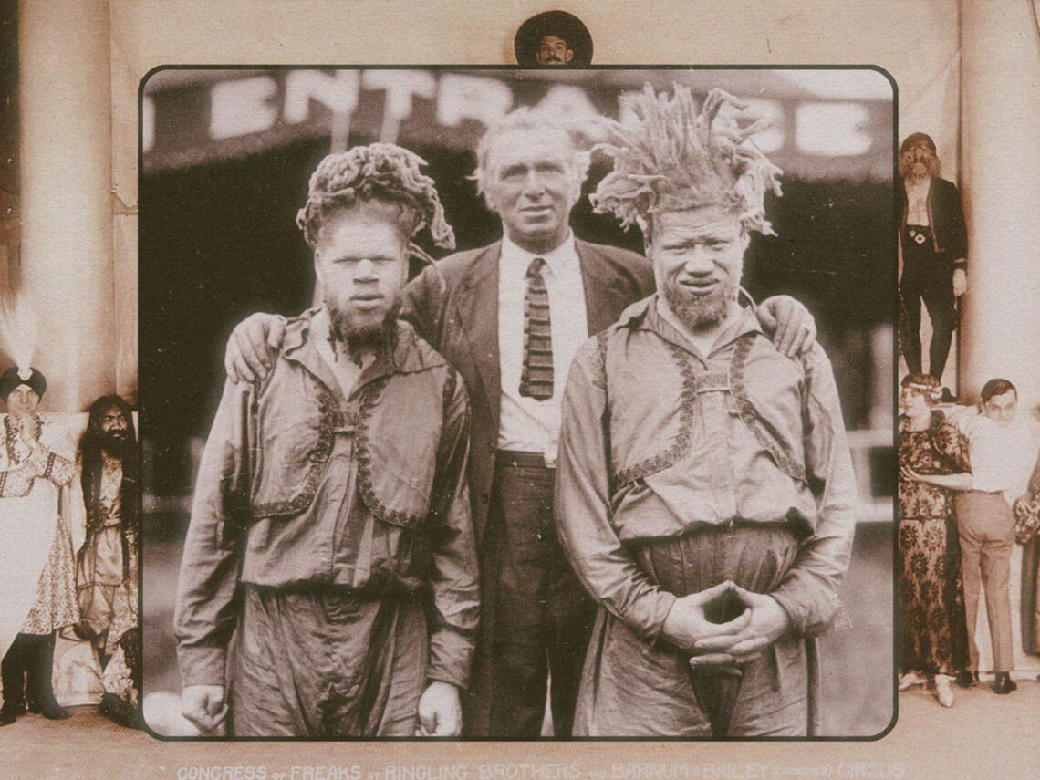The brothers kidnapped by a freak show in 1899