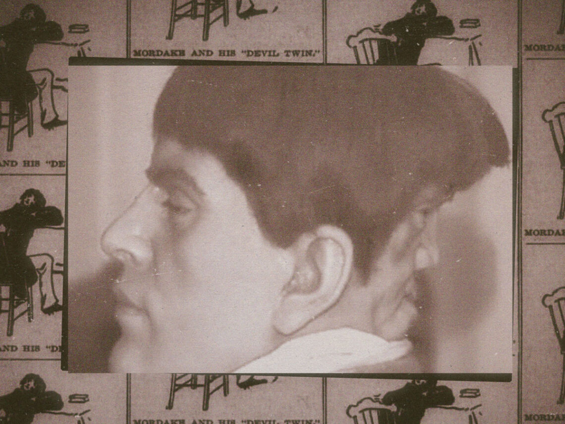 A demon on the back of your head- The true story of Edward Mordrake
