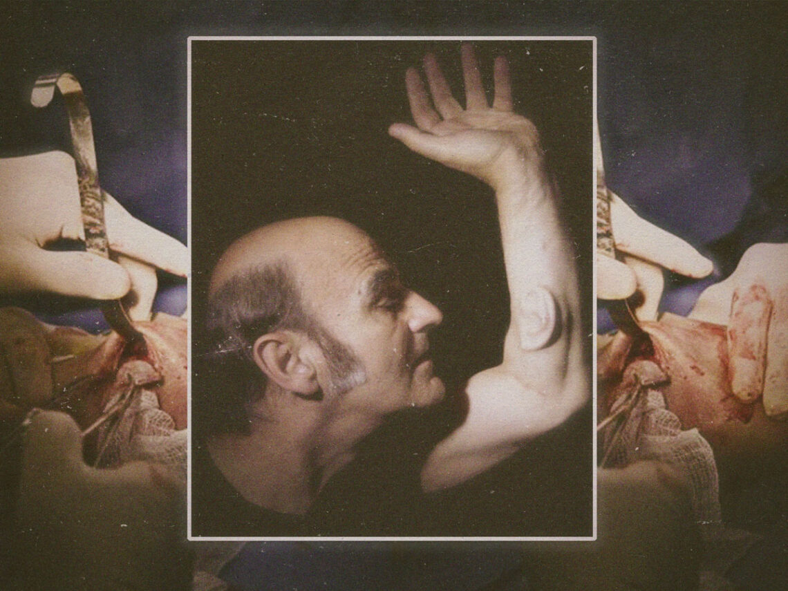 The performance artist that grew a third ear onto his arm