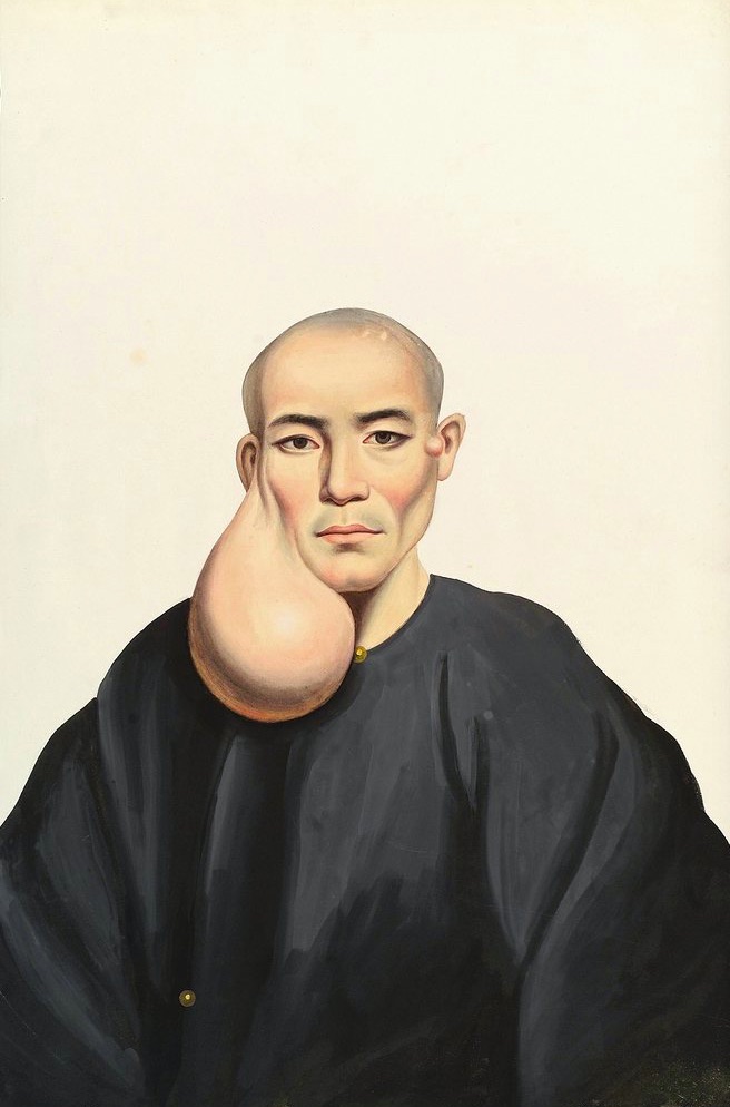 006diseasependtumr1835.jpg