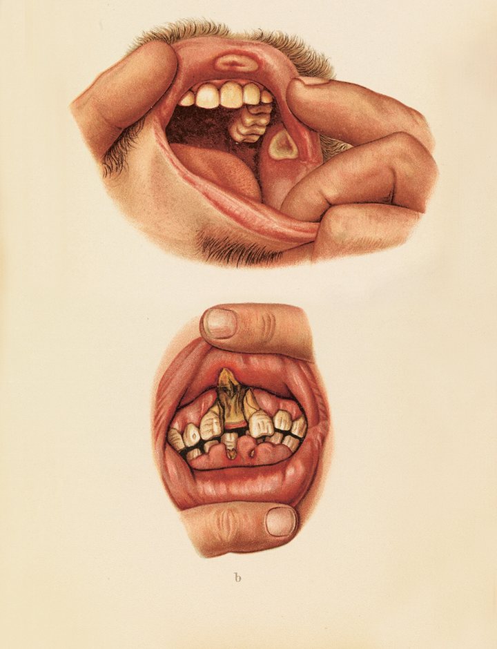 012diseasmou.jpg