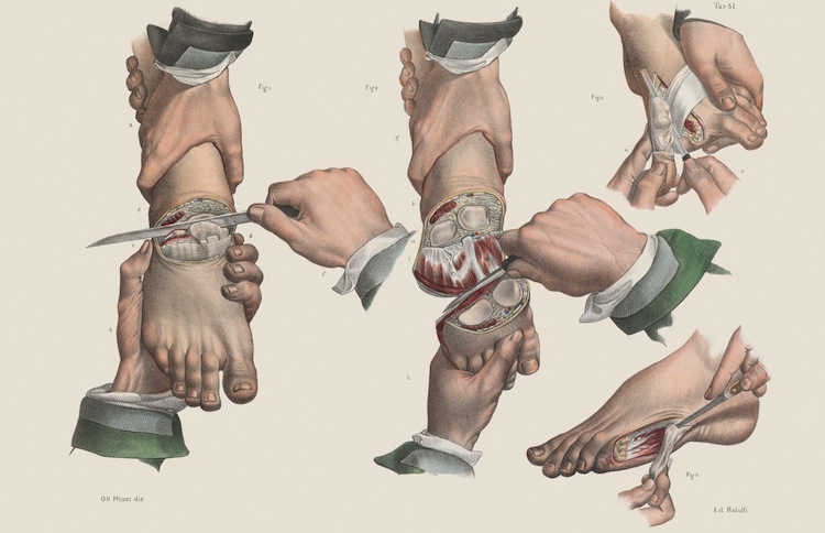 014surgeryillus.jpg