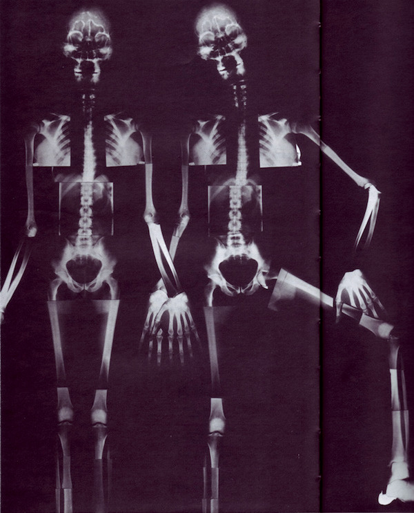 017Radiographies.jpg