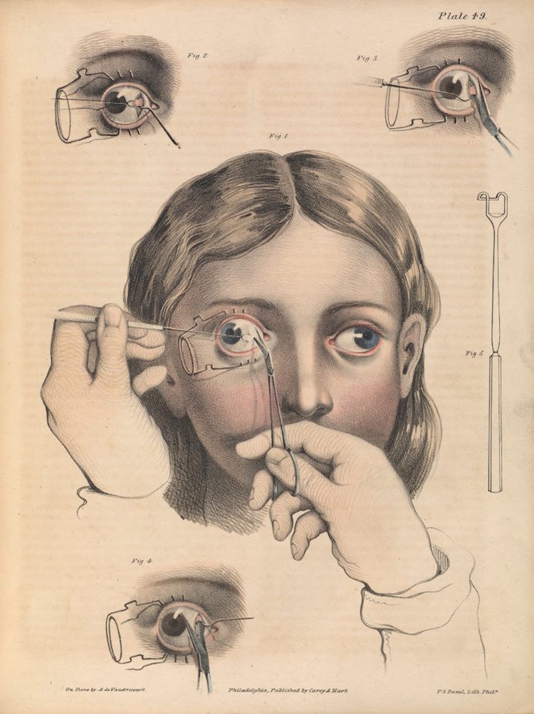 01surgeryillus.jpg