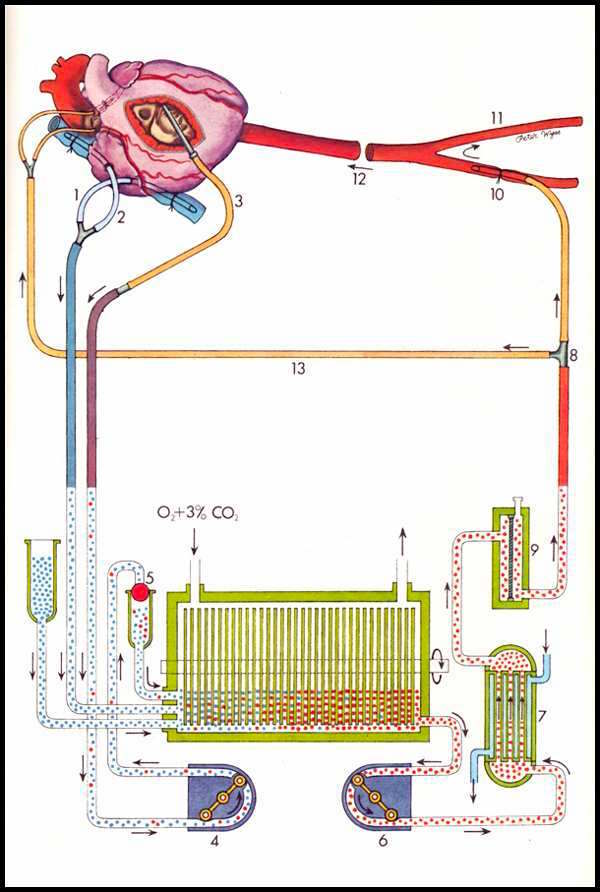 024La_machine_coeur_poumon_P_Wyss.jpg
