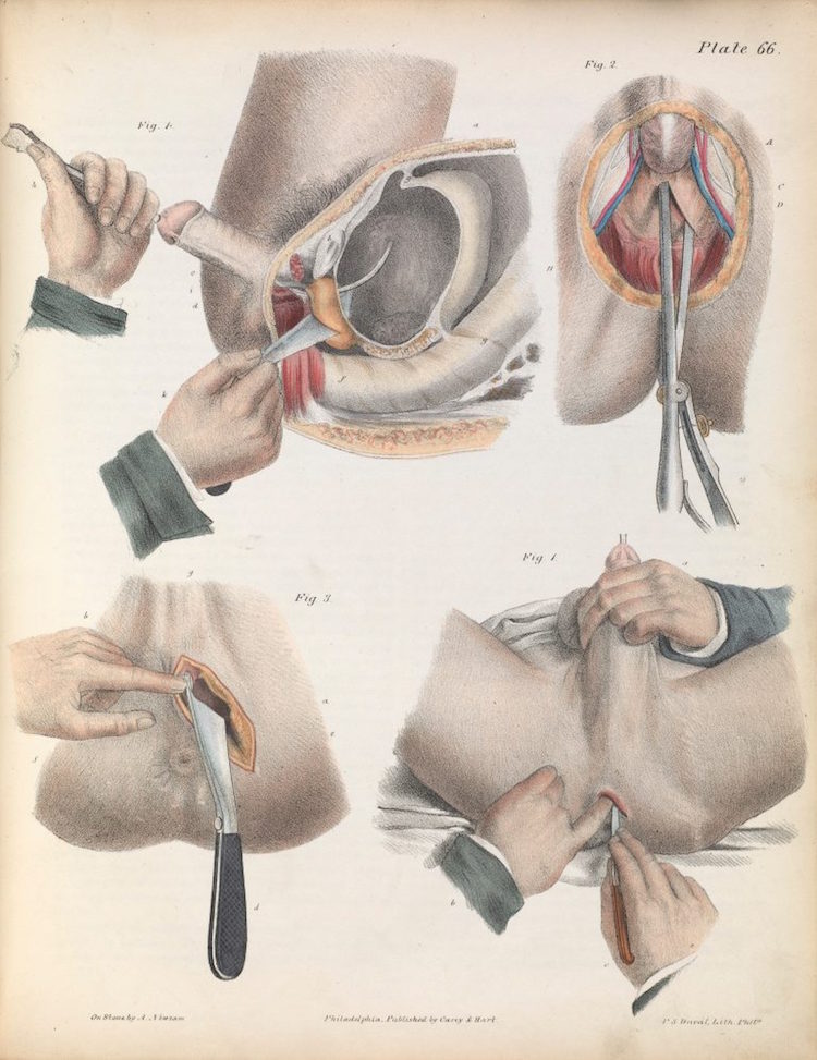 02surgeryillus.jpg