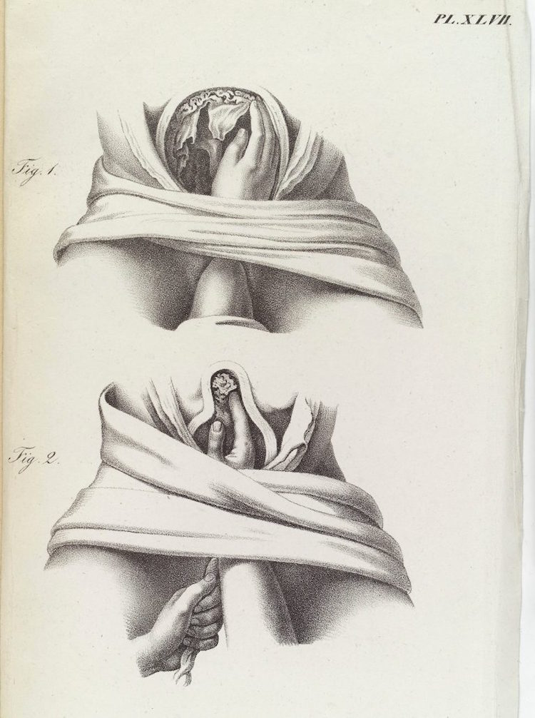 05surgeryillus.jpg