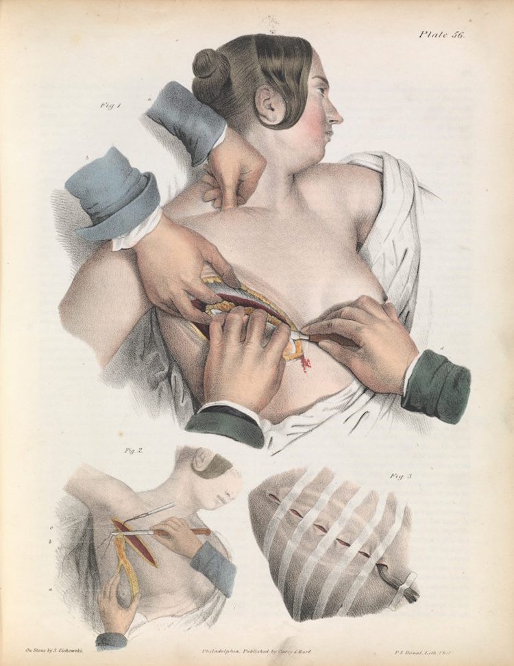 06surgeryillus.jpg