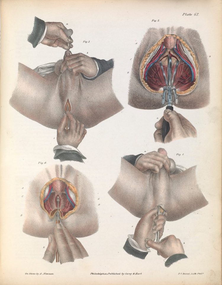 07surgeryillus.jpg