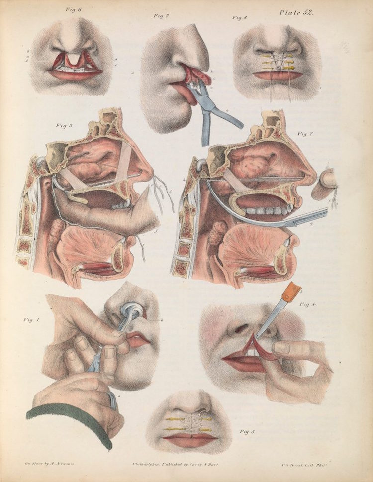 08surgeryillus.jpg