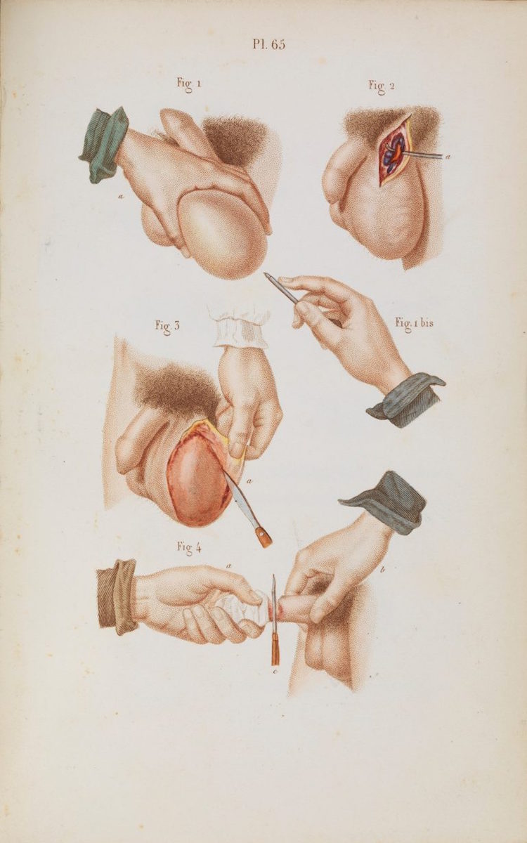 09surgeryillus.jpg