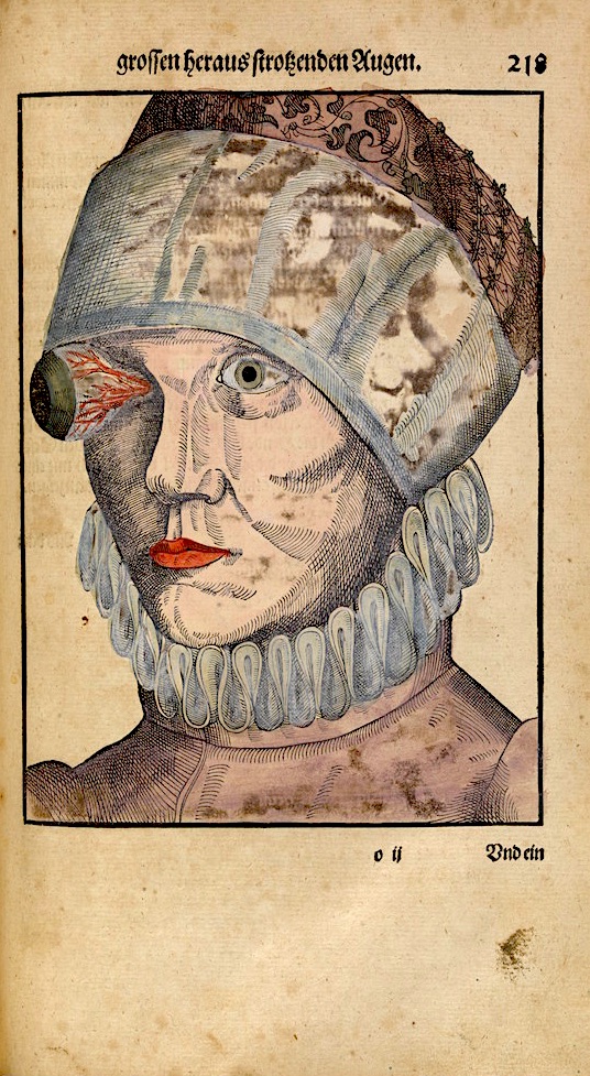 0_1opthal8.jpg